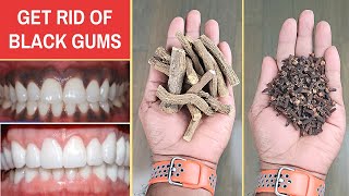 REVERSE BLACK GUMS NATURALLY | Best Remedy To Treat Black Gums Naturally