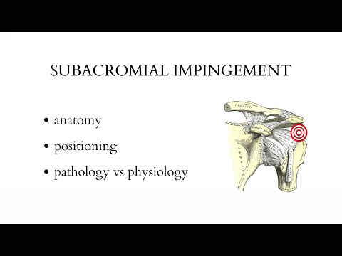SUBACROMIAL IMPINGEMENT - musculoskeletal ultrasound examination