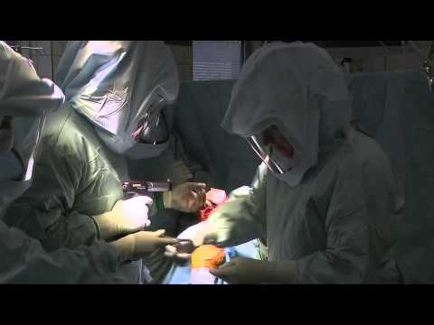 Rückenschmerzen in Woche 12 Wie die Schmerzen im Rücken der Grippe zu entlasten