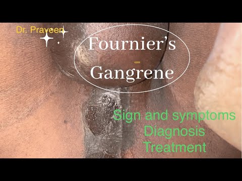 FOURNIER’S GANGRENE | FOURNIER GANGRENE | DR. PRAVEEN PATIL