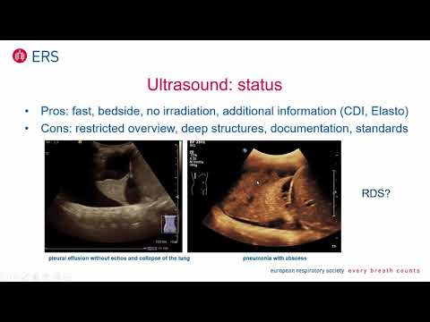 Radiology in Children by Dr Meinrad Beer