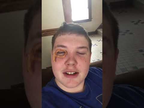 YouTube Thumbnail