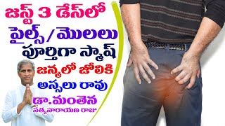 How To Get Relief From Piles In 3 Days | పైల్స్ మొలలు స్మాష్ | Dr Manthena Satyanarayana Raju
