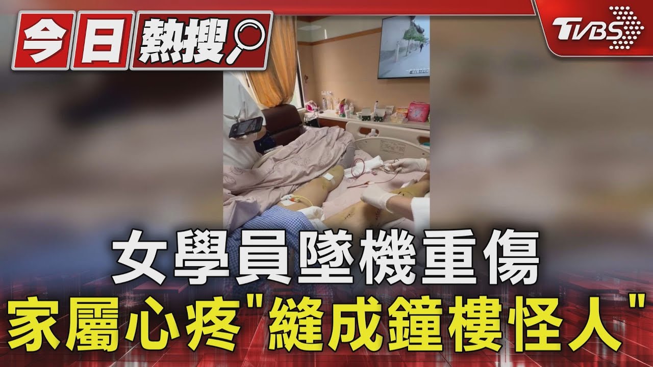 女學員墜機重傷　家屬心疼「縫成鐘樓怪人」