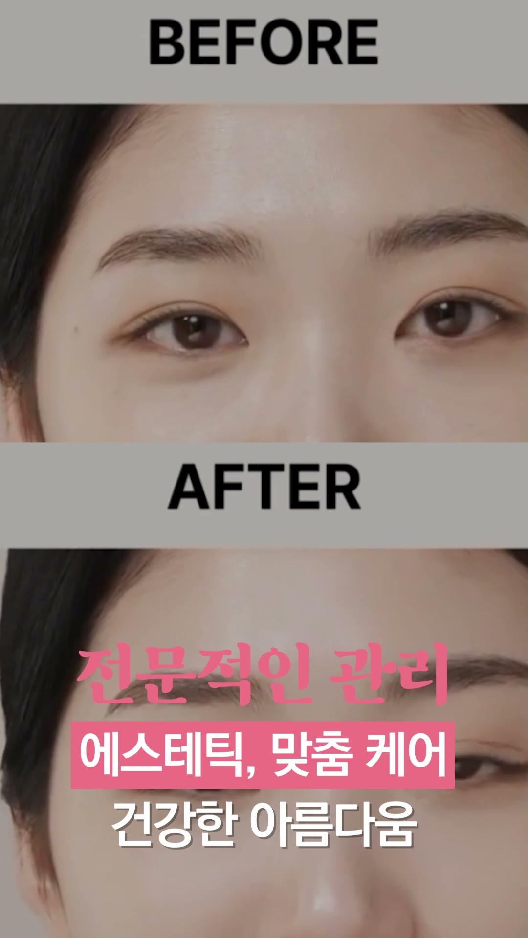 제주 셀루미 에스테틱 | 시간을 되돌리는 줄기세포 동안 관리 리얼 후기! 🤫 #셀루미에스테틱 #제주피부관리 #동안관리 #줄기세포 #얼굴리프팅 #전신케어 #맞춤형관리 #제주노형 #제주에스테틱 #피부탄력 #제주핫플