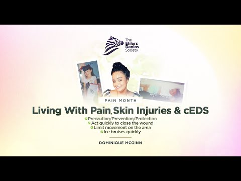 Community Voices: Dominique McGinn "Living with pain, skin injuries, and cEDS."