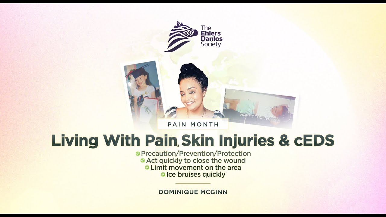 Community Voices: Dominique McGinn  "Living with pain, skin injuries, and cEDS."