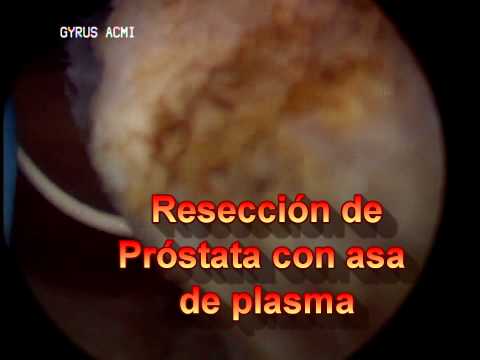 Prezzo prostane Dnepropetrovsk Trattamento della prostatite nei maschi