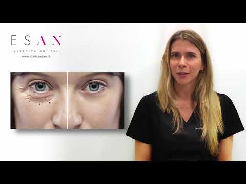 Los mejores tratamientos estéticos para eliminar las ojeras