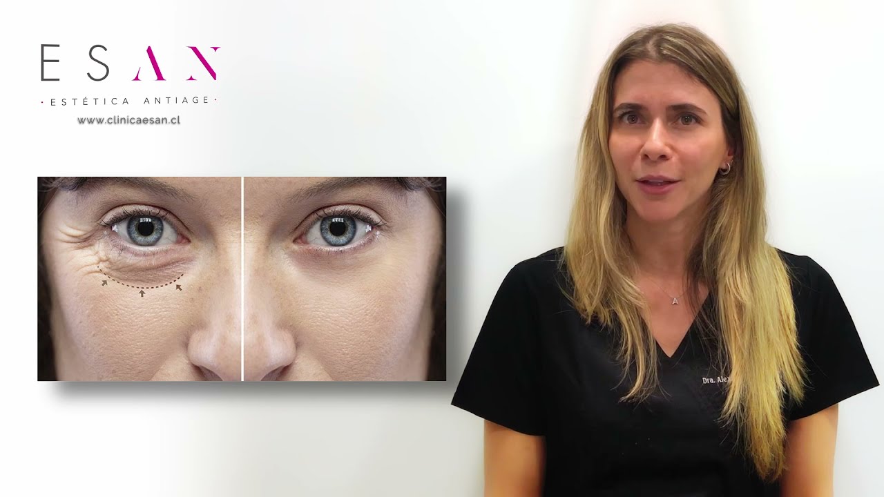 Watch Los mejores tratamientos estéticos para eliminar las ojeras Now Los mejores tratamientos estéticos para eliminar las ojeras