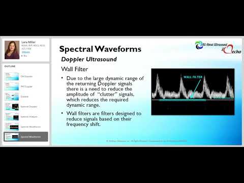 Spectral Doppler  - Wall Filter