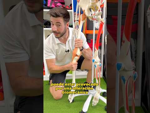 ¿DOLOR AL DOBLAR LAS RODILLAS? 🙃 #fisioterapia #dolorrodilla #ejerciciorodilla