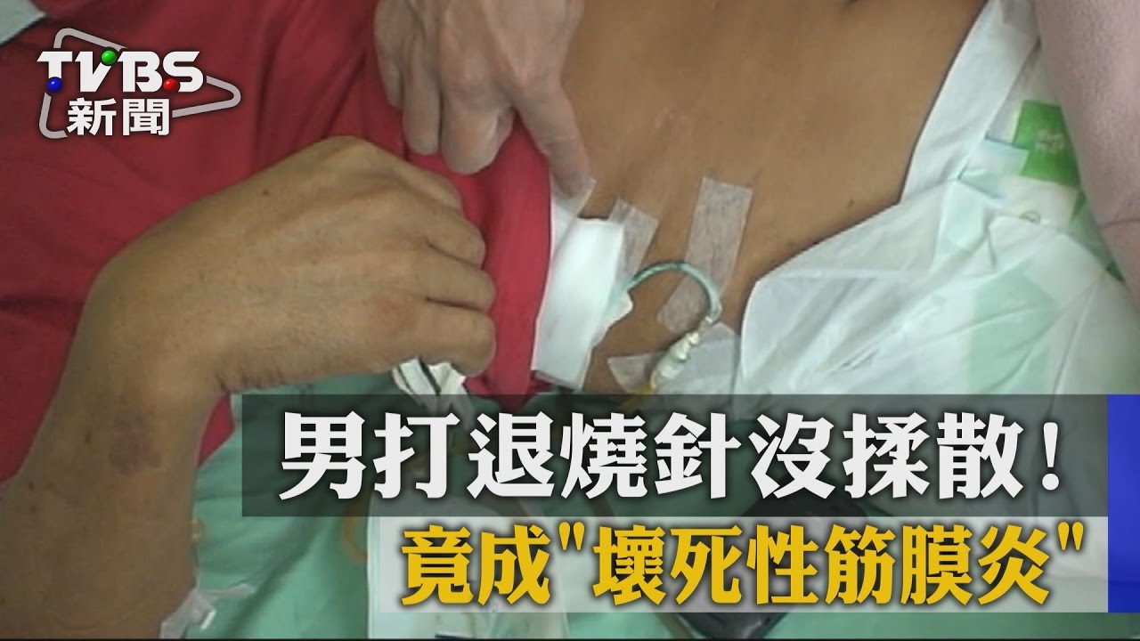 男打退燒針沒揉散!竟成「壞死性筋膜炎」
