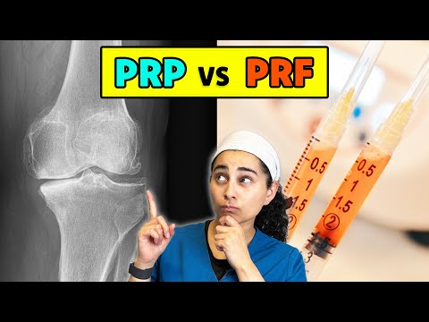 PRP vs PRF: Which Works Better for Joint Pain?