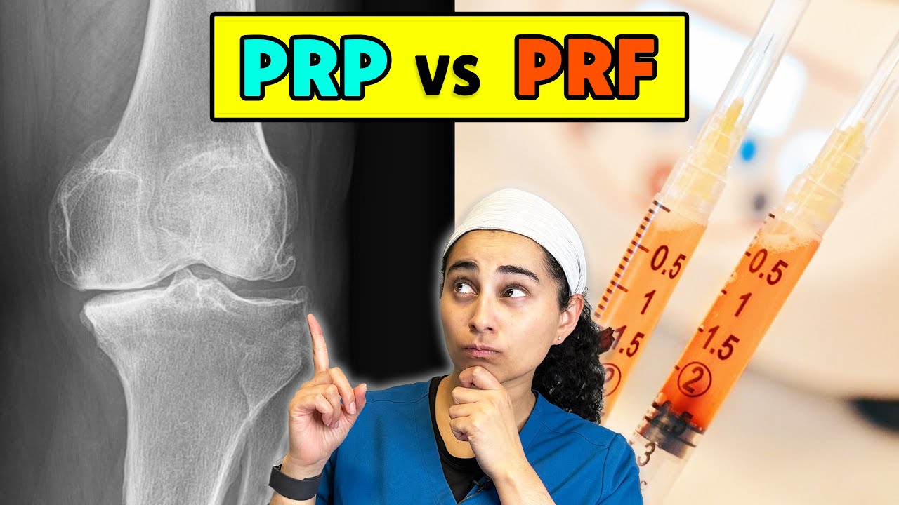 PRP vs PRF: Which Works Better for Joint Pain?