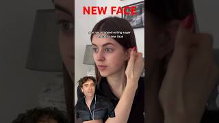 STOPPED SUGAR GOT NEW FACE