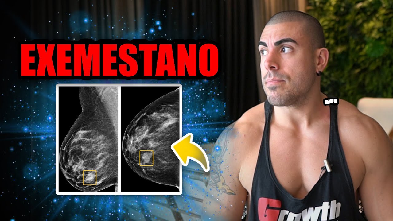 Tudo sobre exemestano *anti-aromatizante*