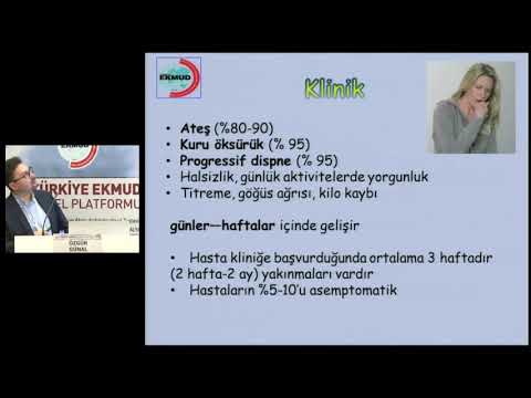 27 pneumocystis jiroveci pnomonisi