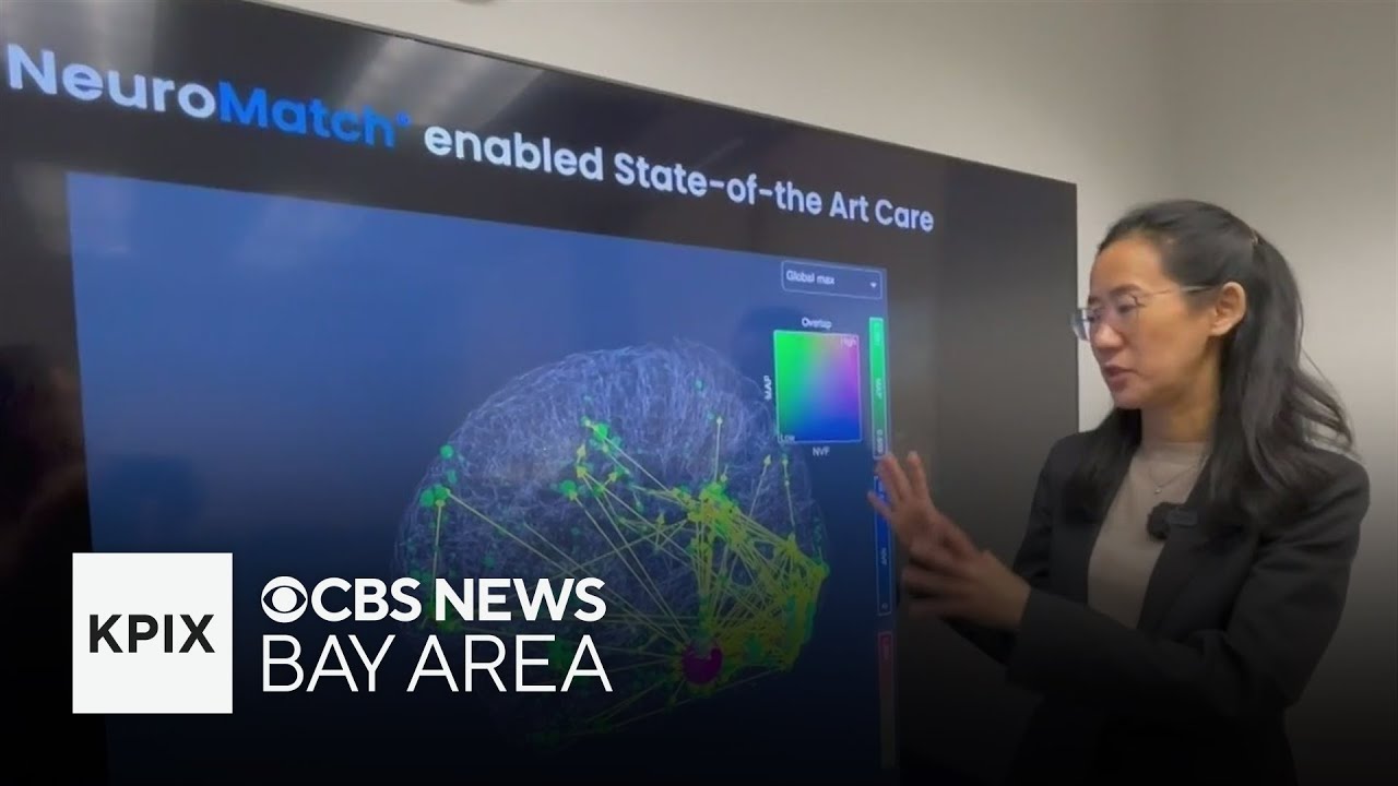 Stanford professor creates digital map of brain’s signal flow to help heal brain injuries
