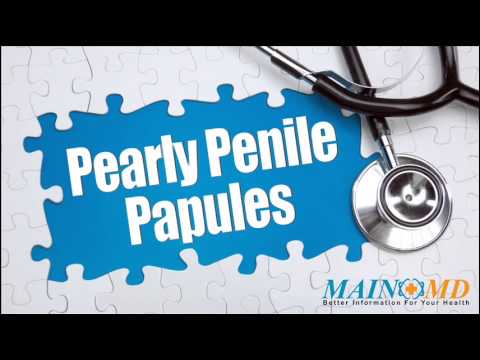 Pearly Penile Papules ¦ Treatment and Symptoms