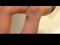 Ice Bath Challenge