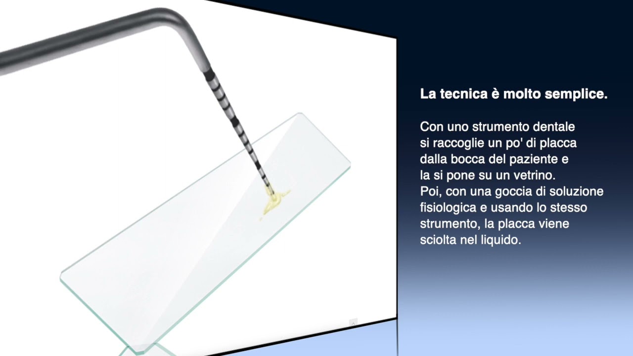 Guarda come si vedono bene i batteri vivi