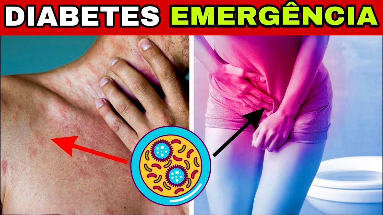 6 EMERGÊNCIAS do DIABETES que você NUNCA pode IGNORAR (Açúcar Alto no Sangue)