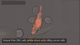 Natural killer cell(White blood cells) killing cancer cells