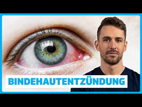 Bindehautentzündung (Konjunktivitis) verstehen: Ursachen, Symptome, Diagnose & Therapie | DocTommy