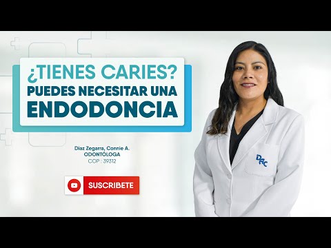 ¿CARIES? Todo sobre Endodoncia