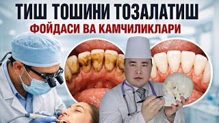 ТИШДАГИ ТОШЛАР НЕГА ХАВФЛИ ВА УЛАРНИ ТОЗАЛАТИШИНИ ФОЙДАЛАРИ НИМАЛАР, КАМЧИЛ