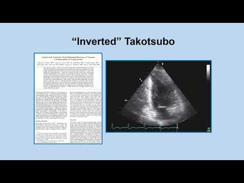 Takotsubo, You Can Really Die of a Broken Heart || HealthspanMD