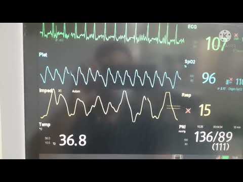 MULTIPARAMETER MONITOR