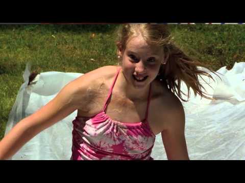 UltraPulse - Giving Burn Scar Patients A New Hope | Lumenis