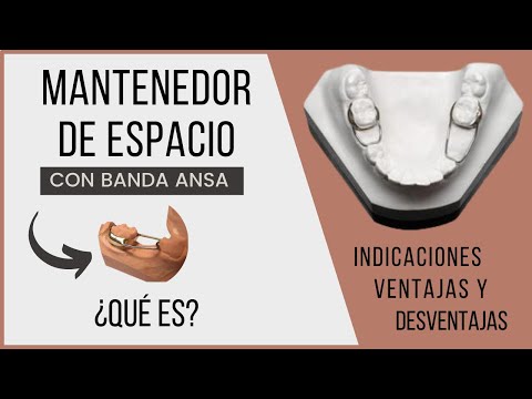 Mantenedor de espacio con banda ansa