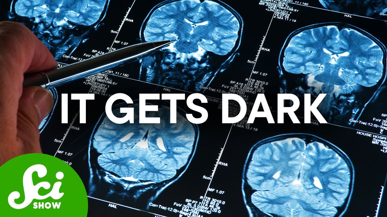 Einstein Didn't Want People To Study His Brain