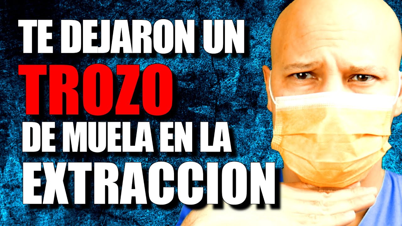 Watch EXTRACCIÓN DENTAL, que 🅽🅾 queden RESTOS👈 Now EXTRACCIÓN DENTAL, que 🅽🅾 queden RESTOS👈