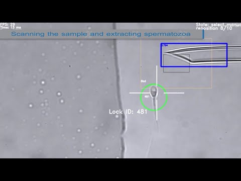 The BAIBYS™ System in action – An AI-based autonomous robotic system for sperm selection for IVF logo