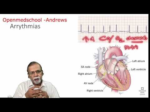 IM 1. 7  PRECIPITATING FACTORS FOR HEART FAILURE