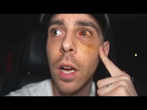 JayStation Has Gone Too Far (LMTH)