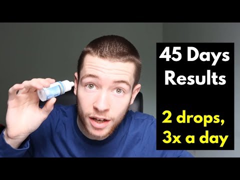 Liquid MSM for Eye Floaters Update 45 days results