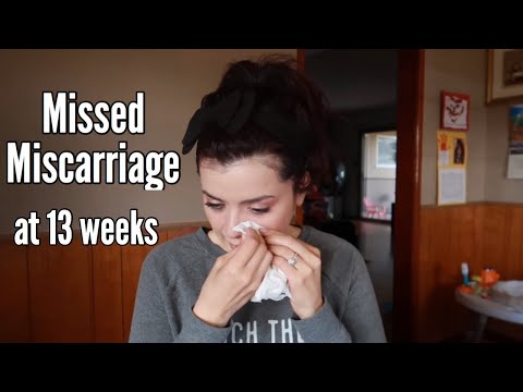 My Miscarriage Story | Missed Miscarriage 13 weeks | Miscarriage Awareness