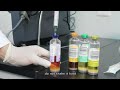 Render Auto Blood Culture For Bacteria Infection Sepsis In Microbiology Lab Or Clinic Department