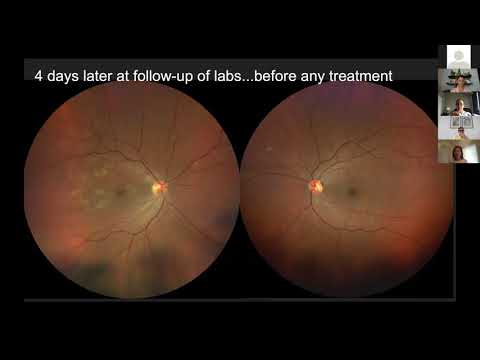YouTube video