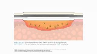 Product video: ADAPTIC TOUCH Silicone Non-Adherent Dressing