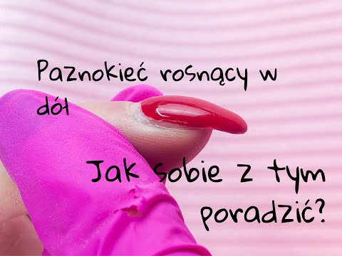 Paznokieć rosnący w dół krok po kroku. Paznokcie żelowe bardzo łatwy sposób
