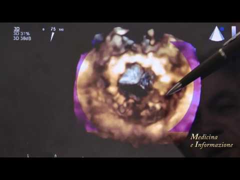 Mal di spalle spalla trattamento articolazioni Rt prezzo articolazioni delle gambe