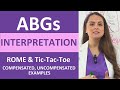 ABGs Interpretation Arterial Blood Gases Acid Base Imbalances ROME Tic Tac Toe Method