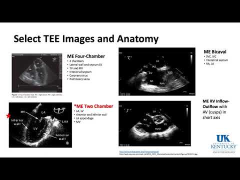 University of Kentucky Cardiac Keyword Review Part 1 of 3 - (Dr. Schell)