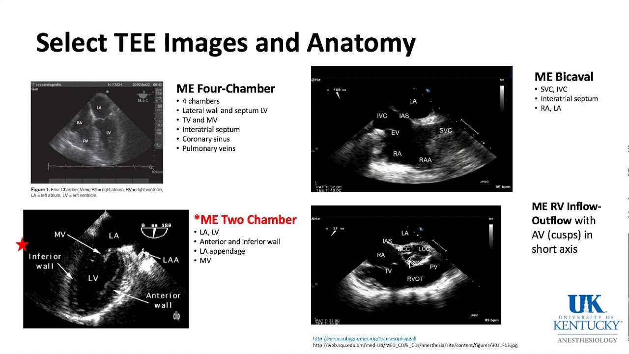 University of Kentucky Cardiac Keyword Review Part 1 of 3 - (Dr. Schell)